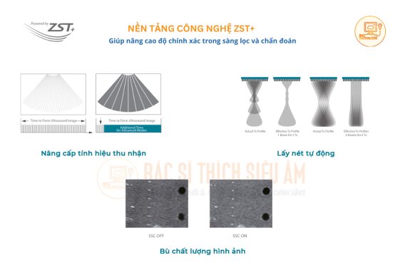 may sieu am xach tay mindray mx3 mx5 nen tang cong nghe