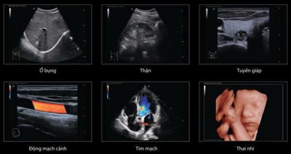 z7588714626465 7a2bcf15e0350797181a57fd46295041